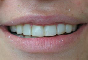 The image displays a close-up view of a person s smiling face with white teeth, showcasing their lipstick and facial features.